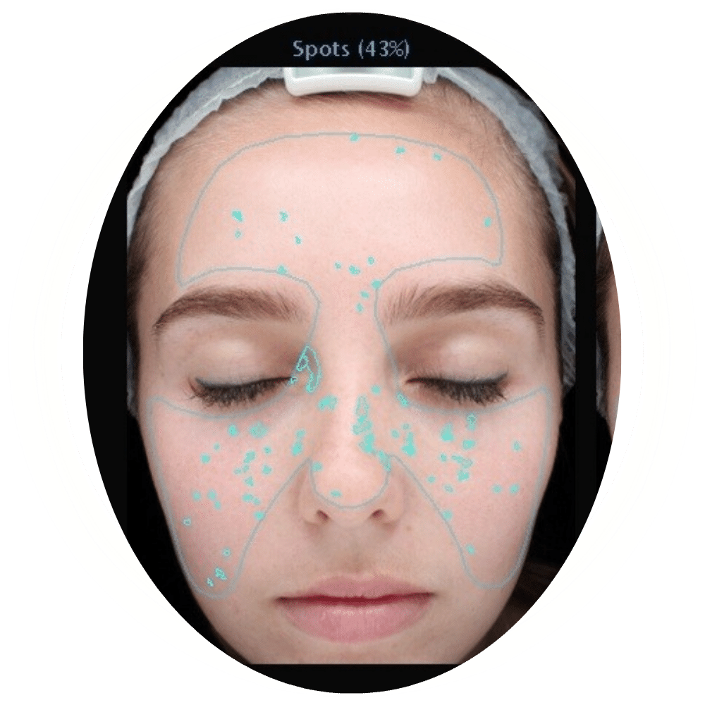 Skin Analysis 8