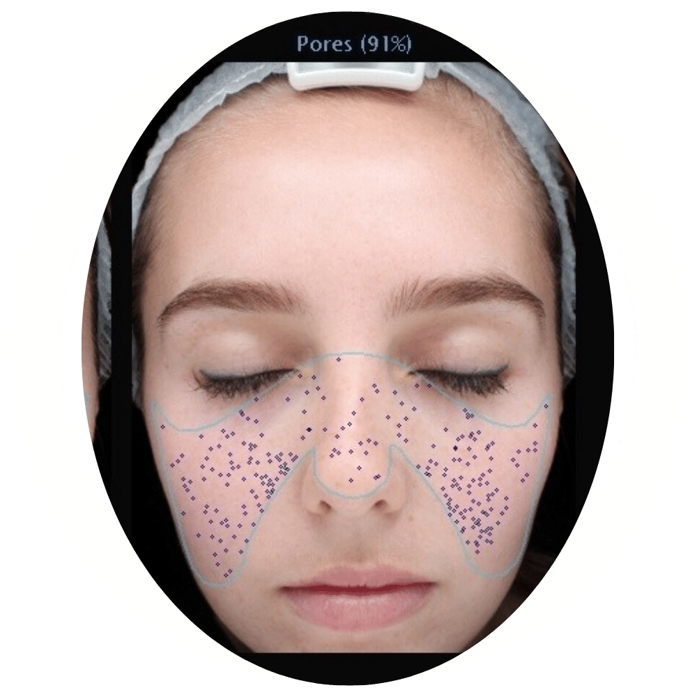 Skin Analysis 6