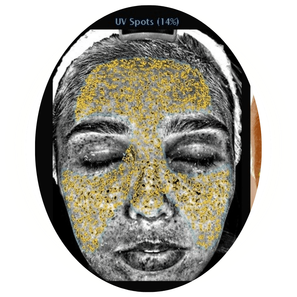 Skin Analysis 2