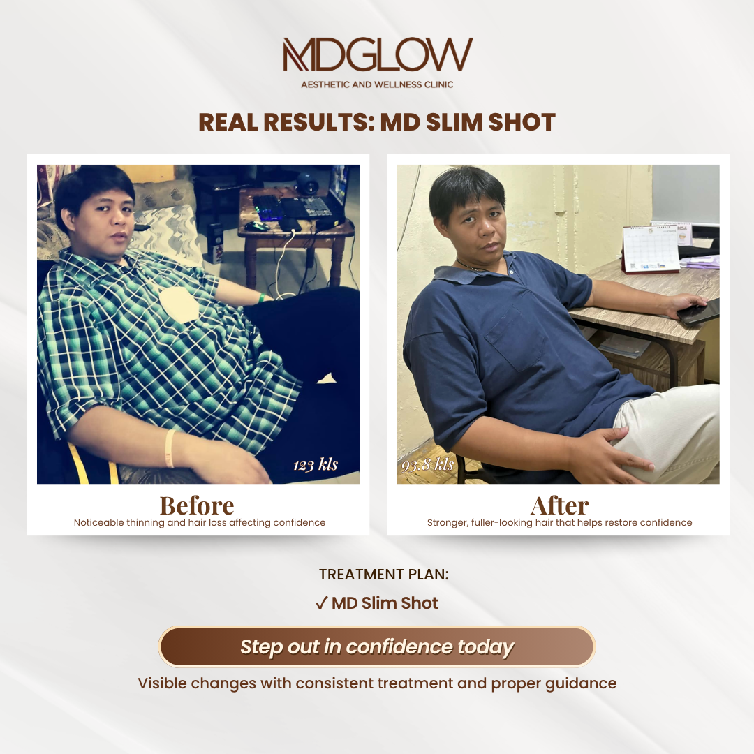 MD Glow Before and After Result