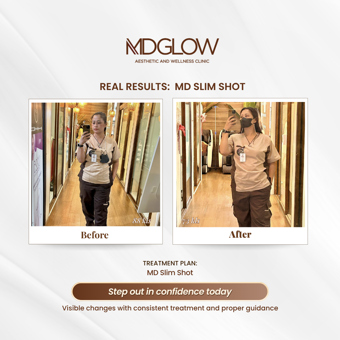 MD Glow Before and After Result