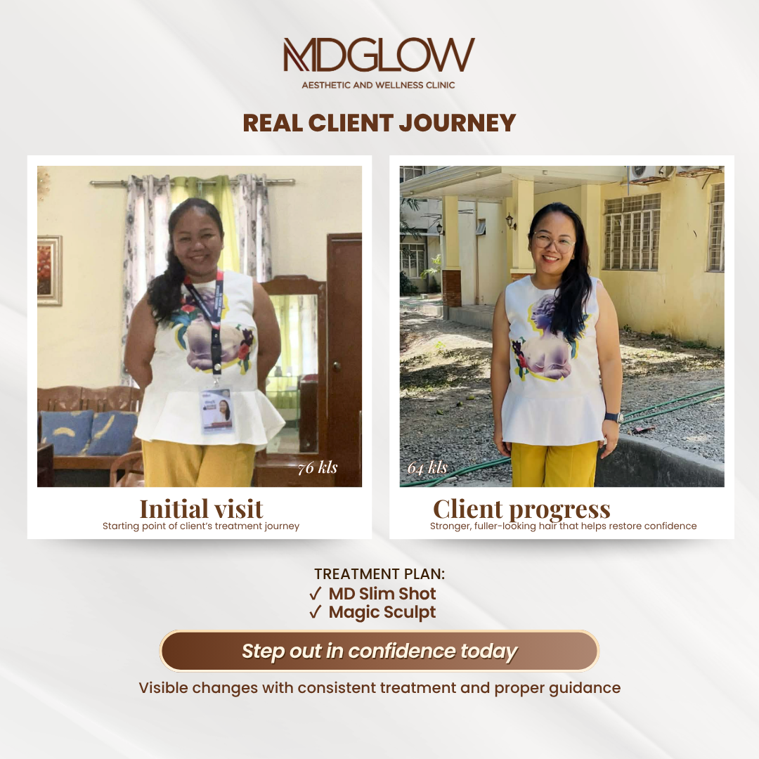 MD Glow Before and After