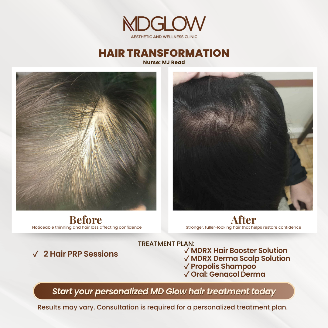 MD Glow Before and After