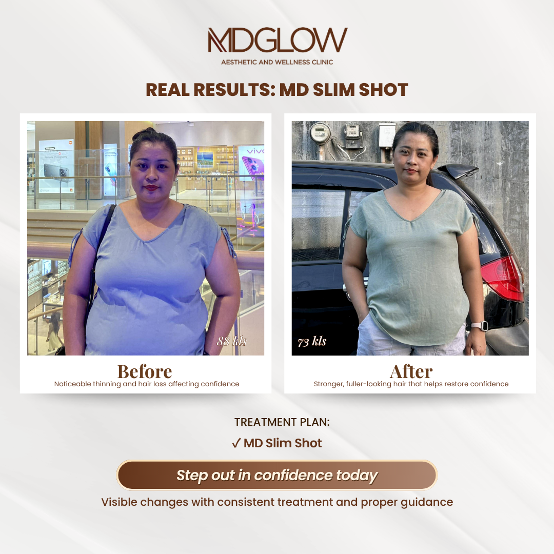 MD Glow Before and After