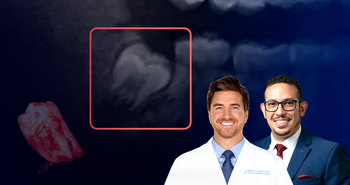 Third Molar Mentorship Program
