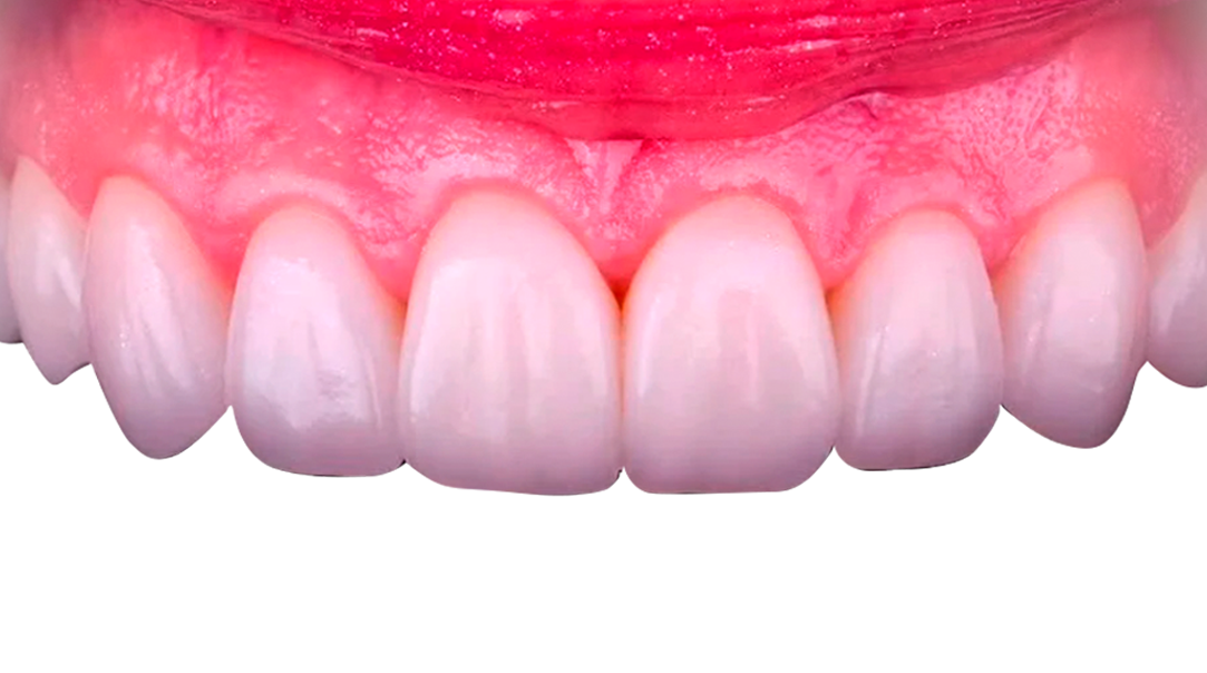 Five Diagnostic Parameters for Aesthetic Cases