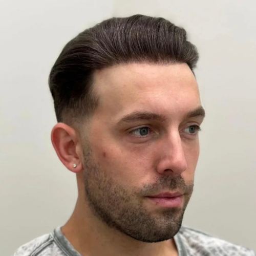 After Savant hair system installation