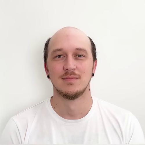 Before Savant hair system installation
