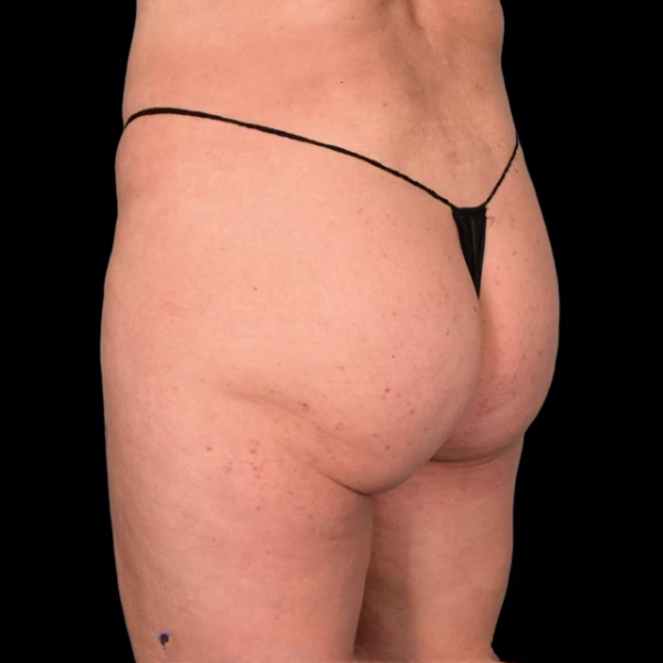 Before — Case 2