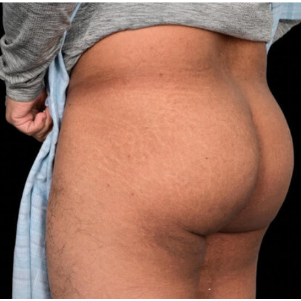 Before — Case 1