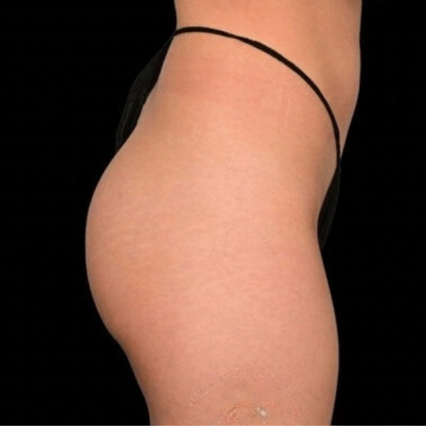 Before — Case 2