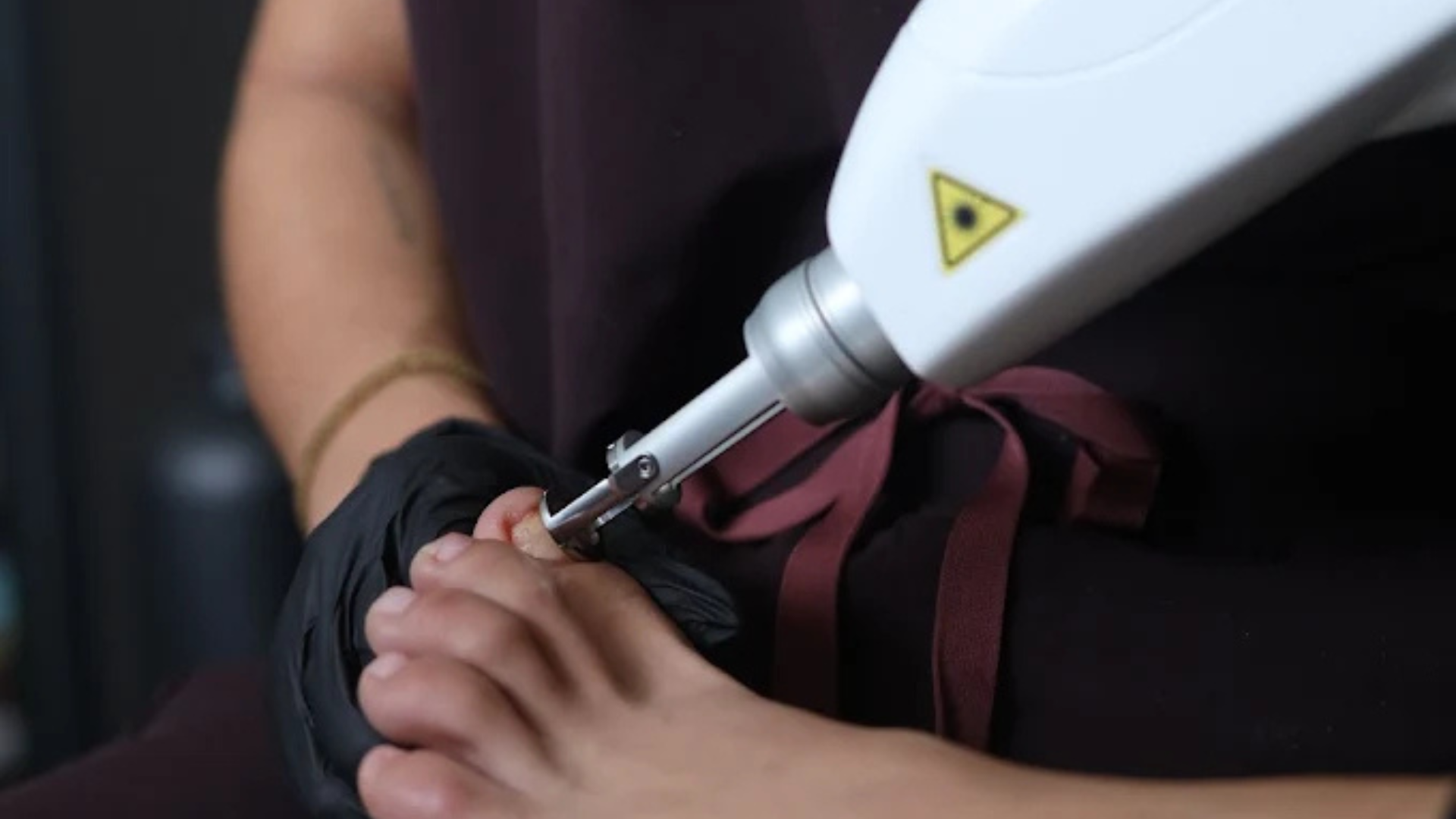 The Treatment That Actually Works - Podiatry Boutique Laser