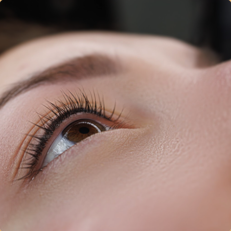 Wimpernkranzverdichtung