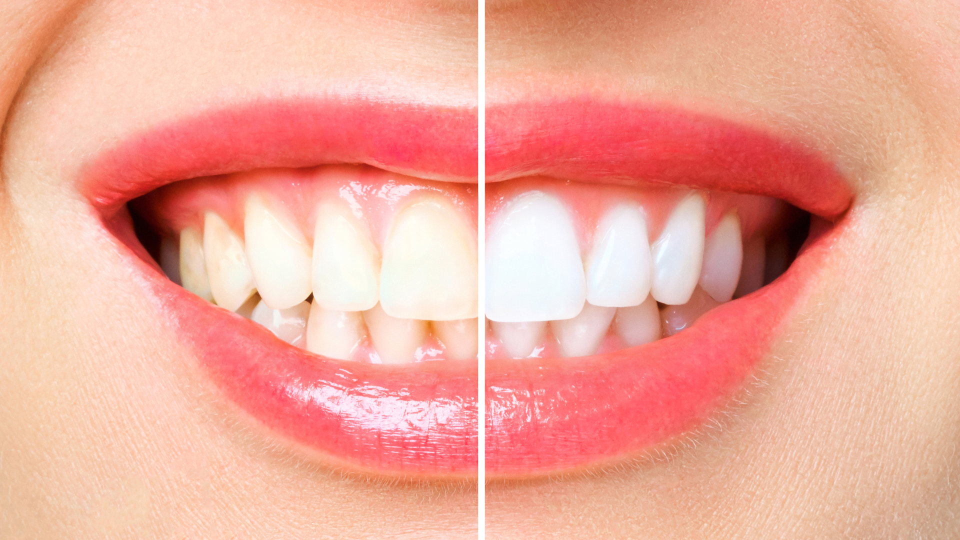 a close-up of a human mouth