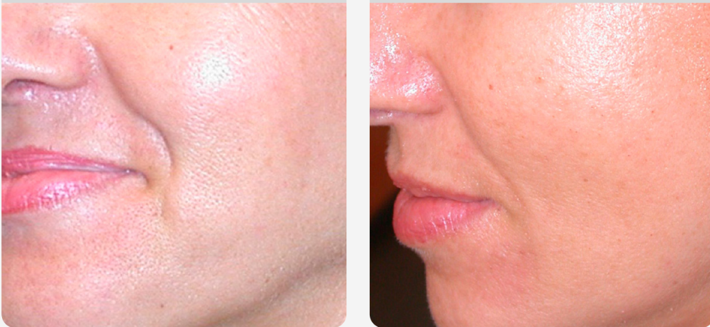 Pores & Texture
