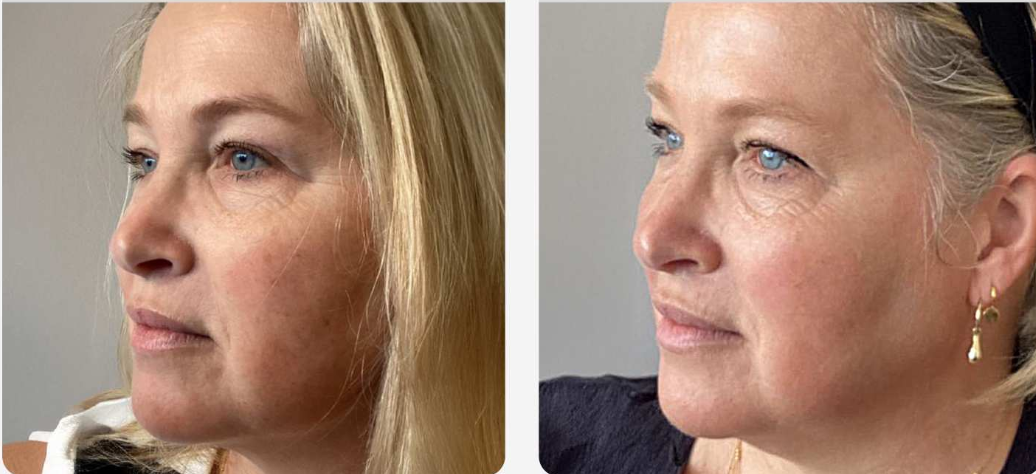 Skin Texture
