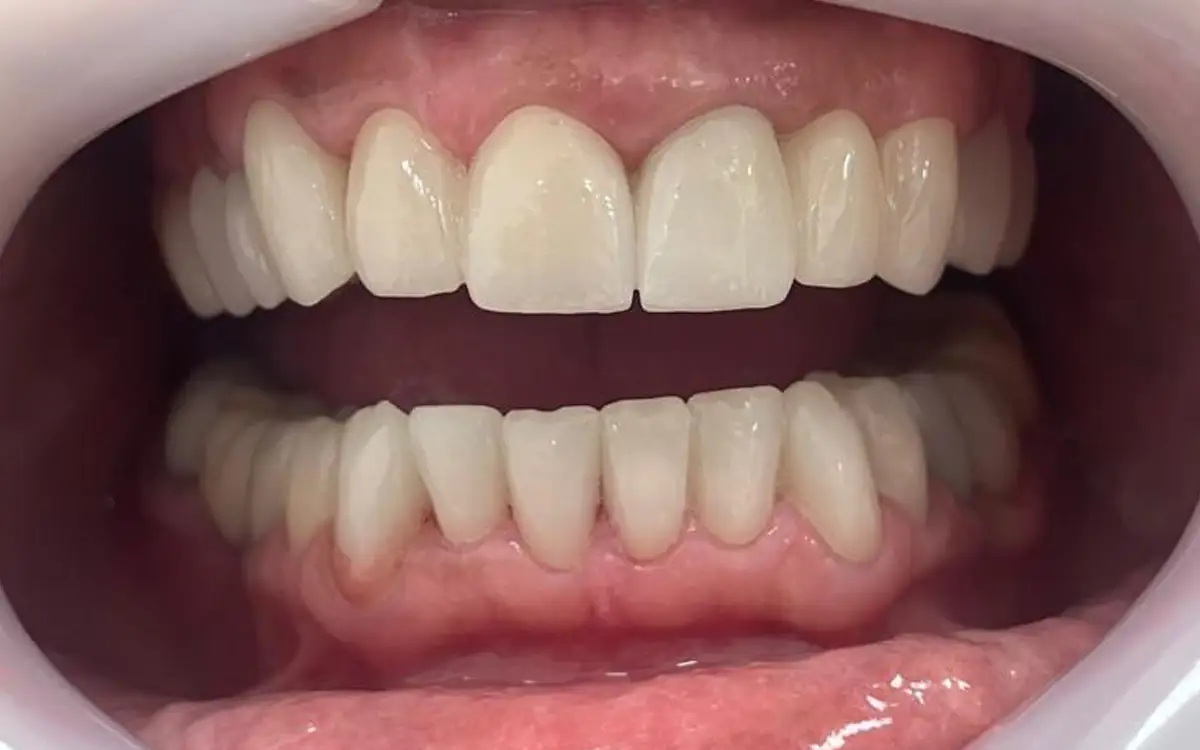 Before dental treatment 3