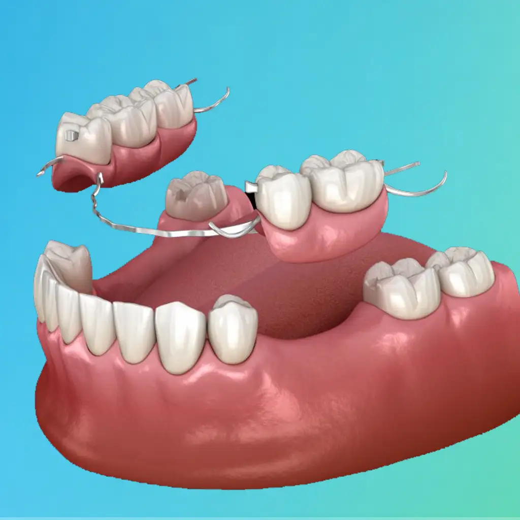 Dental Dentures
