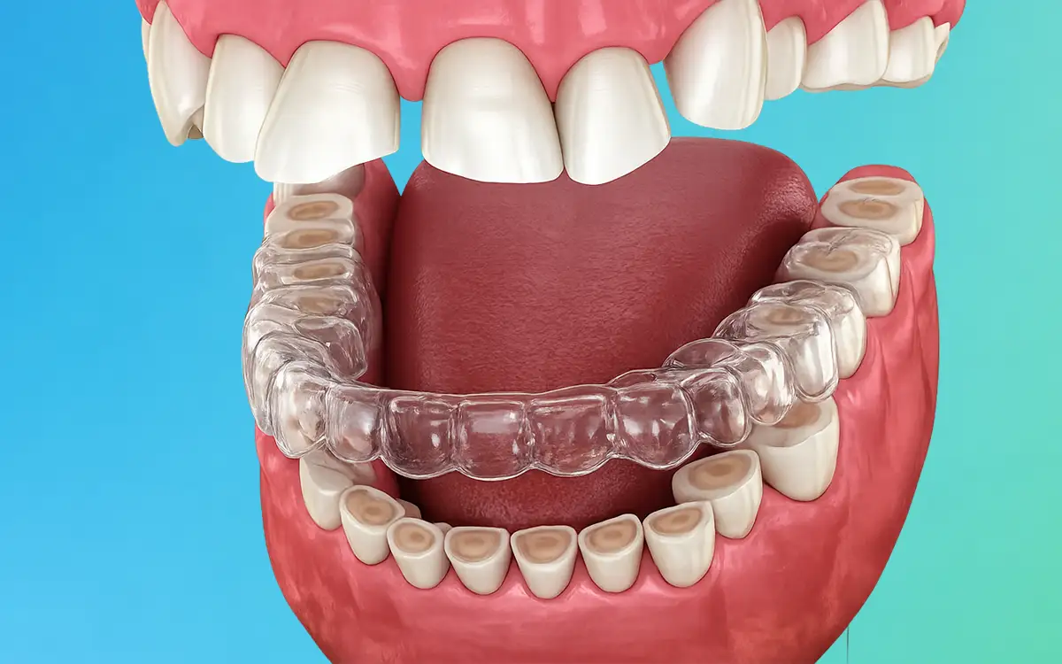 TMJ and Bruxism Support