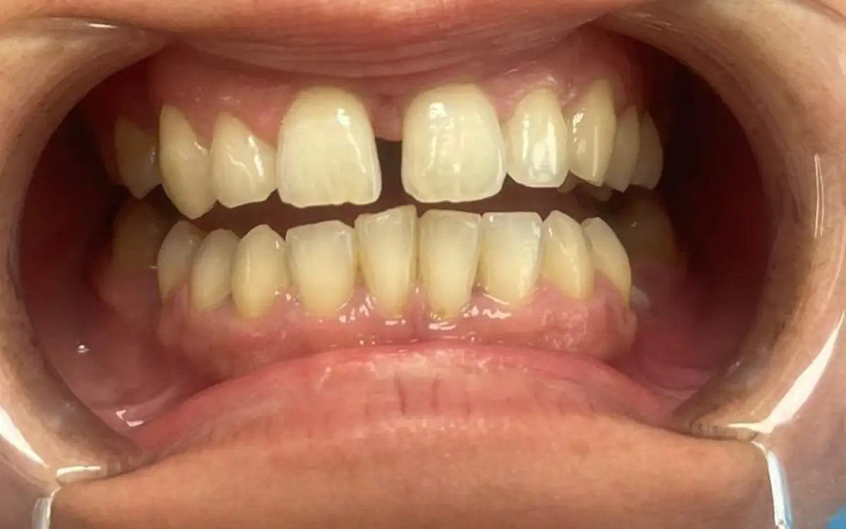 Stanislava before dental treatment