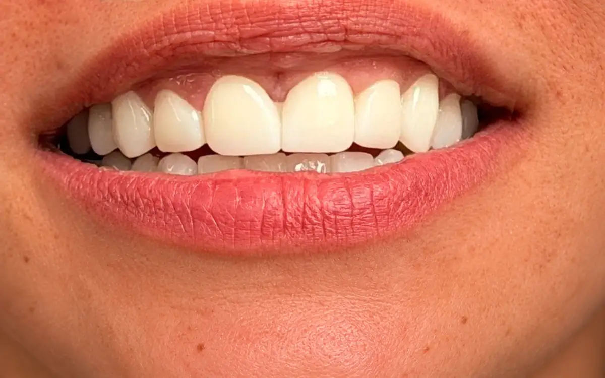 Stanislava after dental treatment