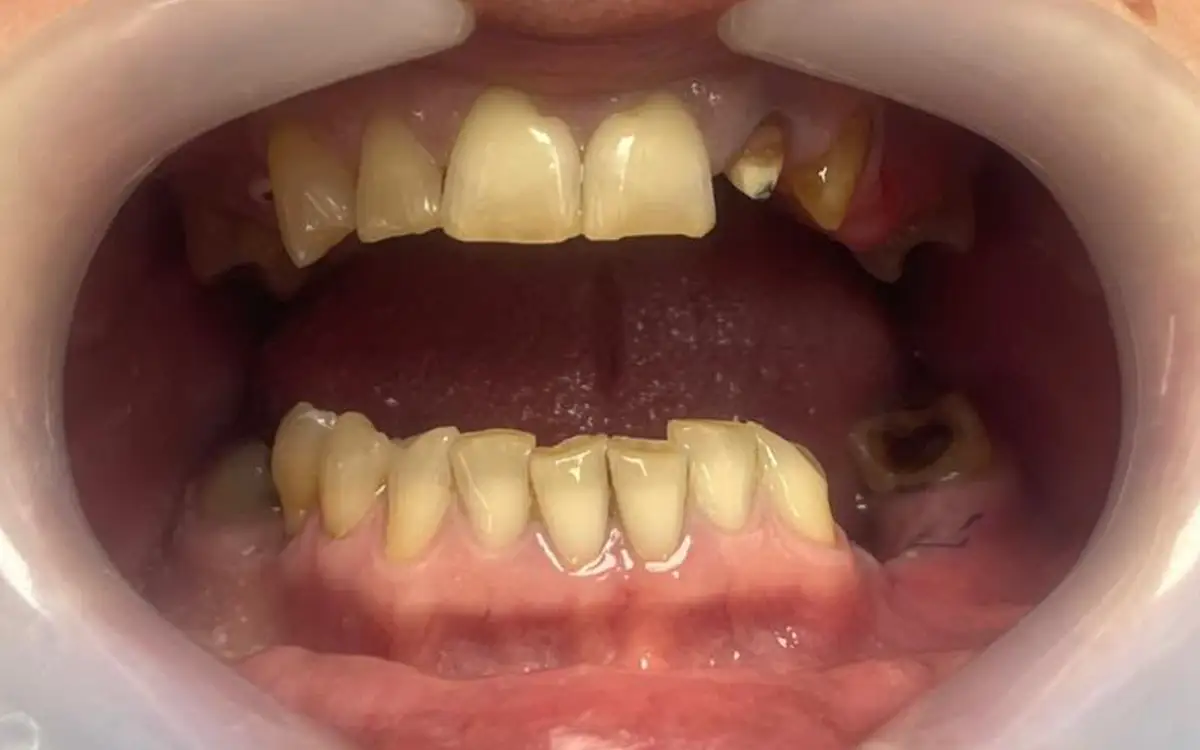 Stefania before dental treatment