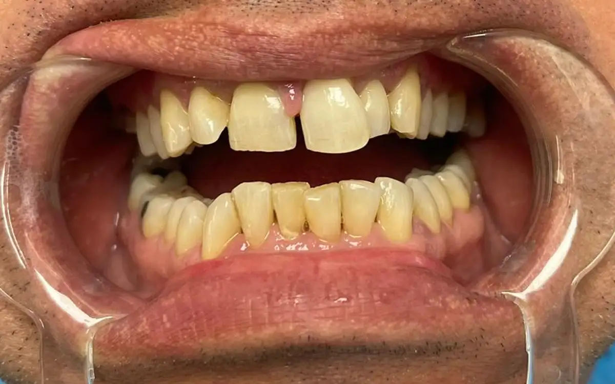 Roman before dental treatment