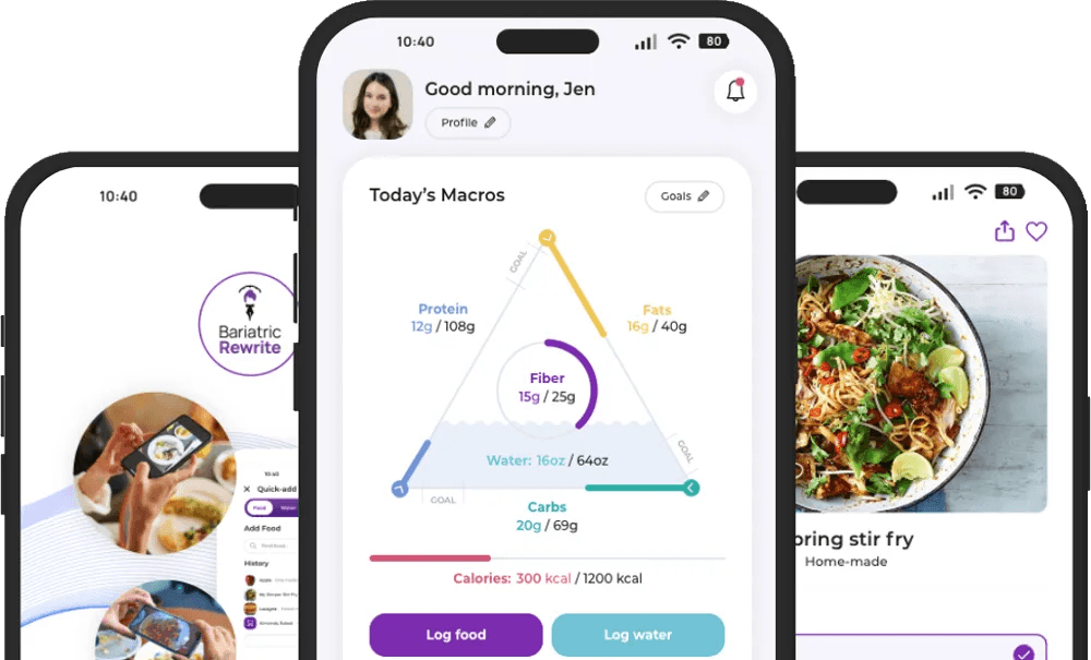 Bariatric Rewrite App Preview