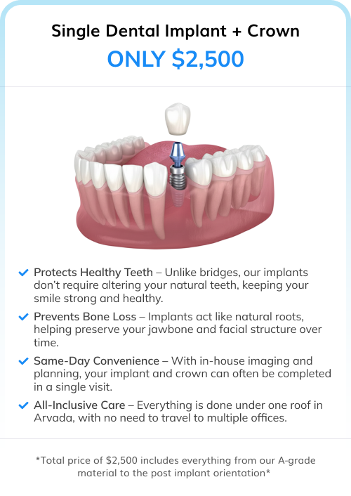 Single Dental Implant + Crown | Only $2,500