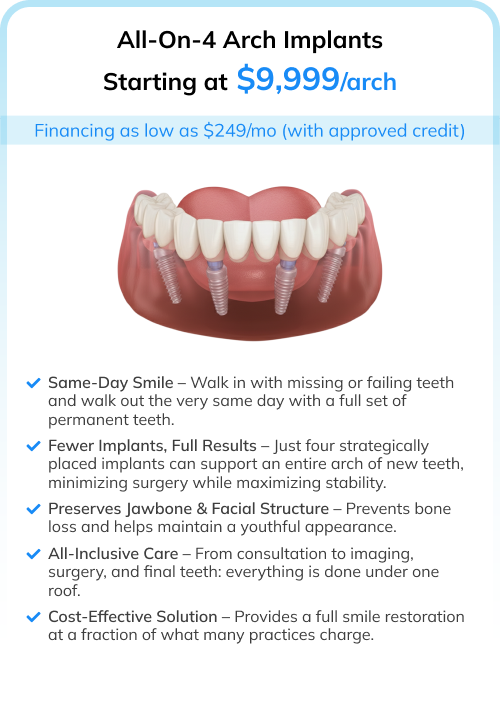 All-On-4 Arch Implants | Only $14,999/arch