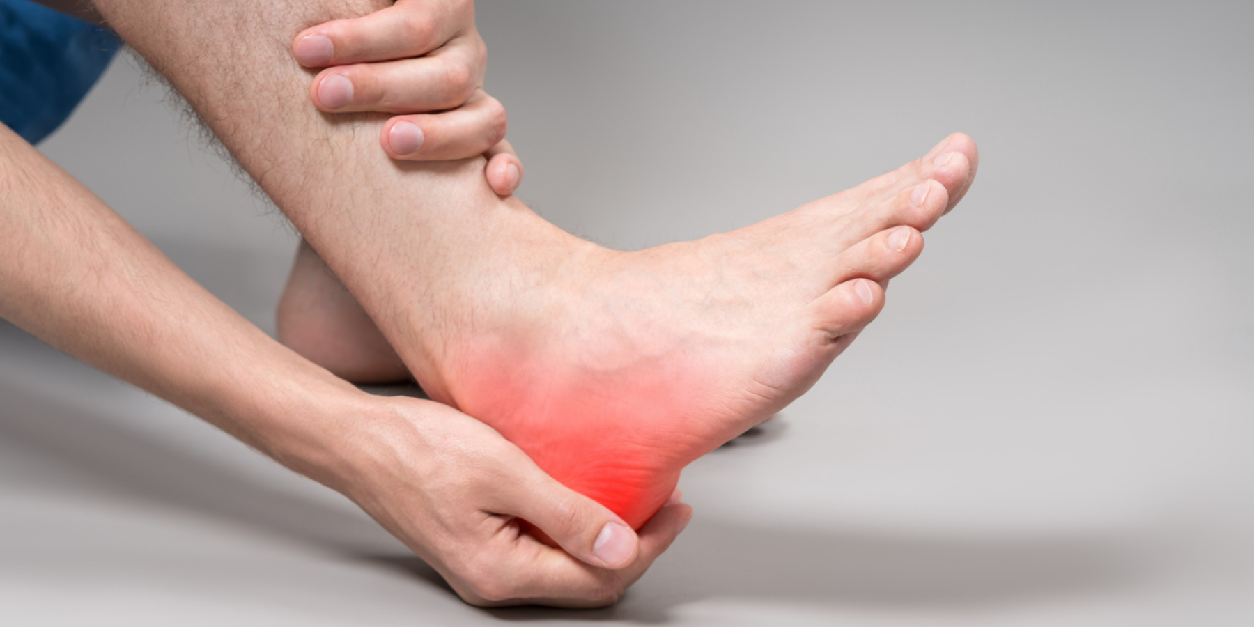 Plantar Fascitis