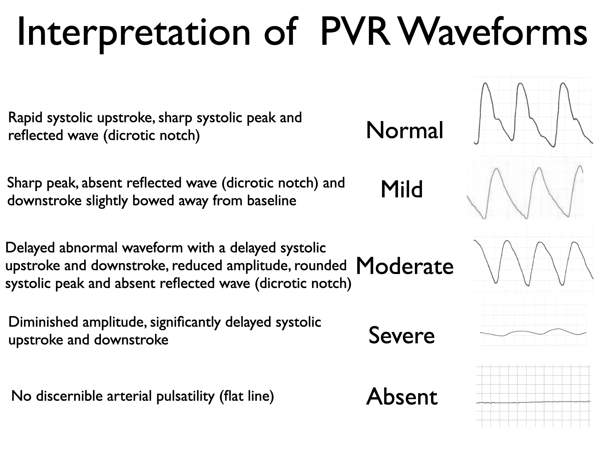 How to Perform and Interpret ABI, Segmental Pressures, and PVR: A Modern Clinical Guide