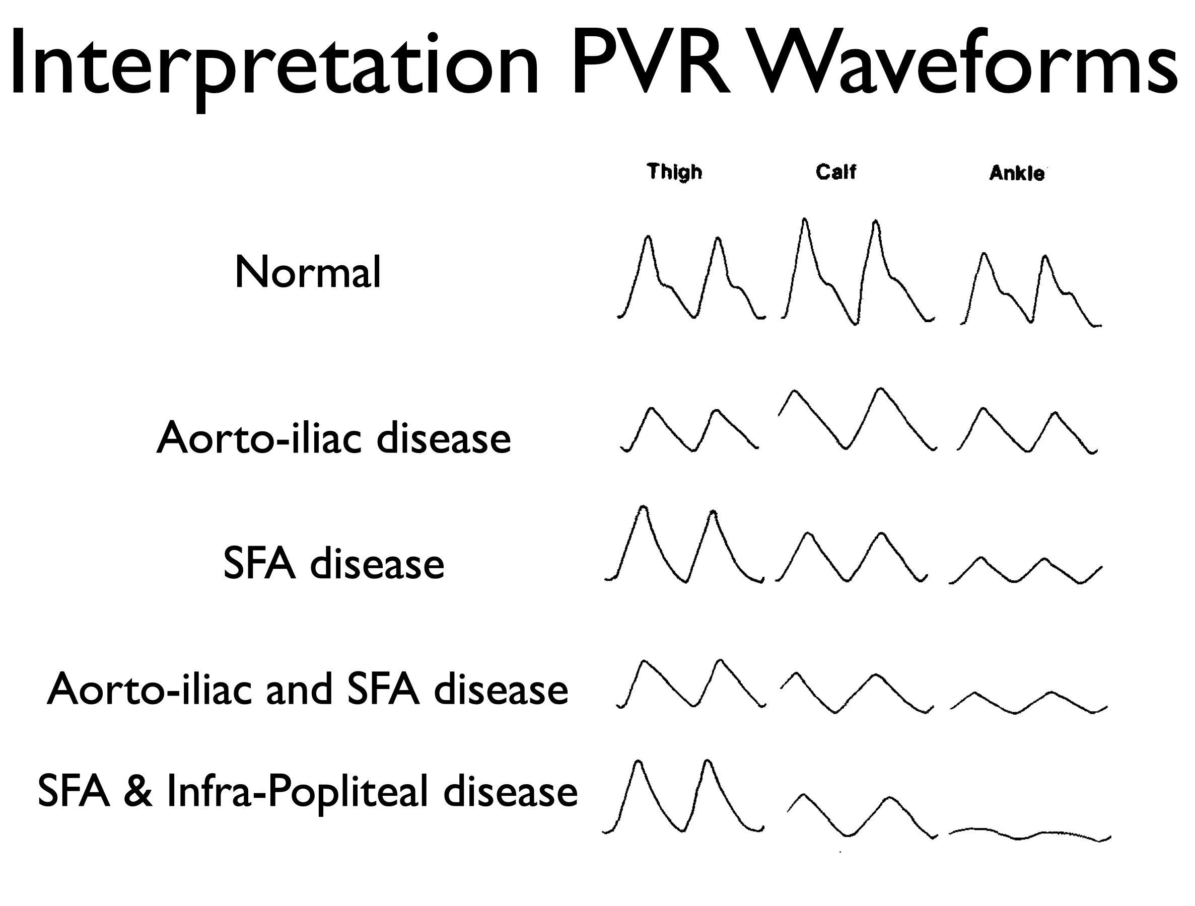 How to Perform and Interpret ABI, Segmental Pressures, and PVR: A Modern Clinical Guide