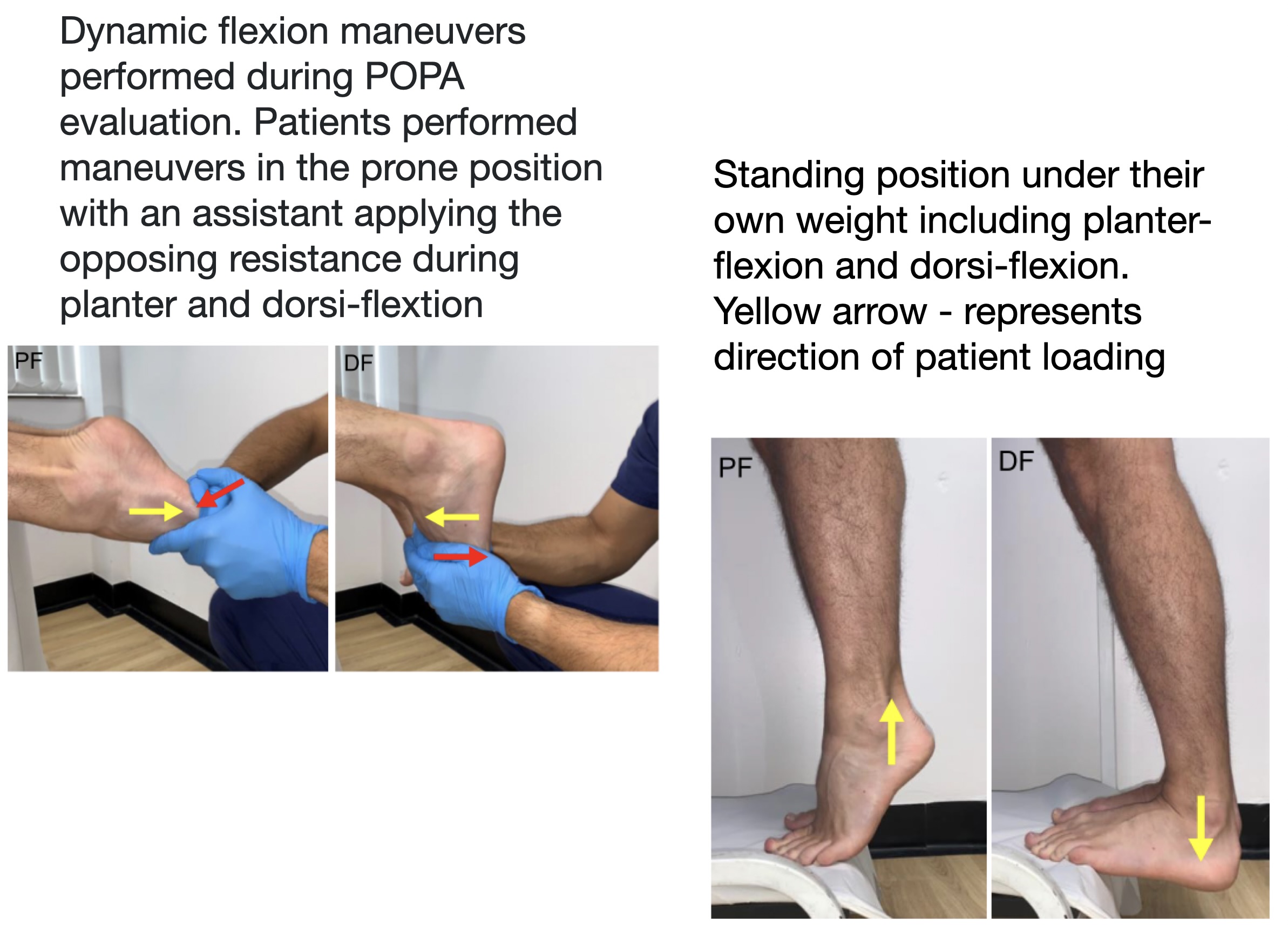 Catching the Hidden Claudicant – Using Duplex Ultrasound to Unmask PAES