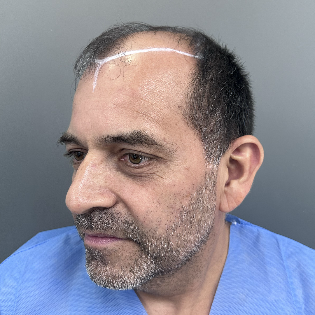 55 años
