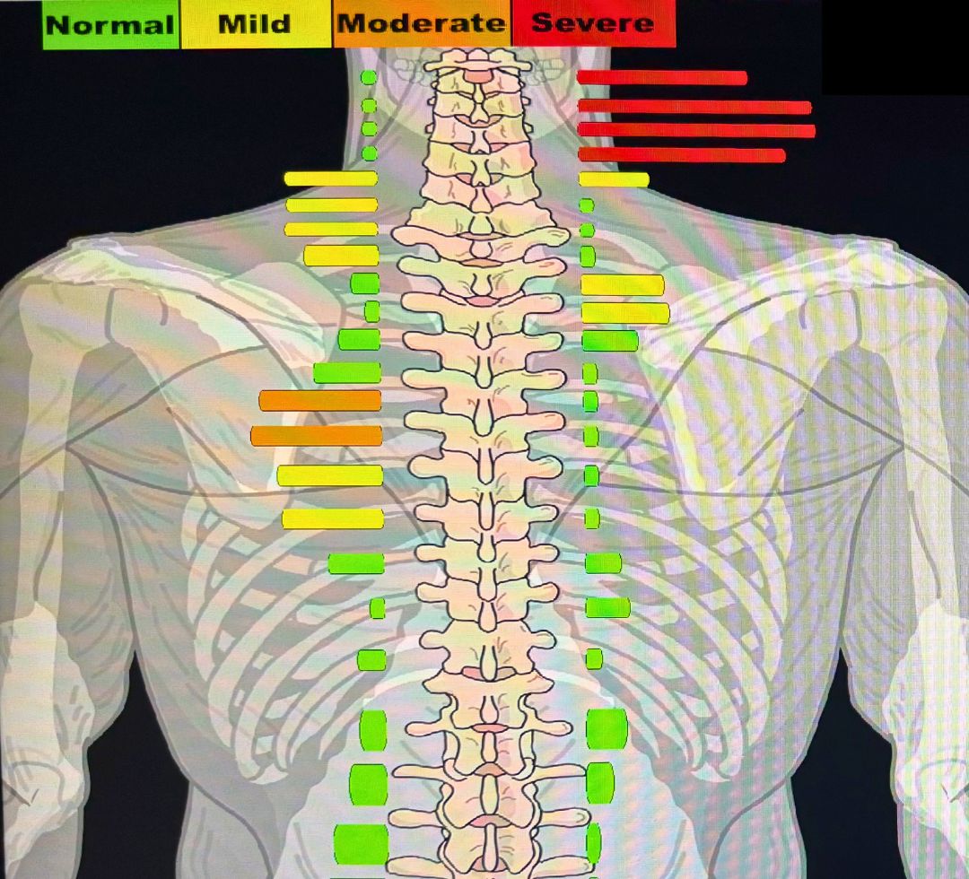 Close-up of an infrared thermography scanner on a patient's neck