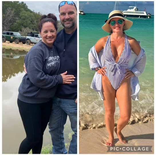 Top transformation image