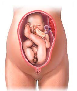 Breech Baby