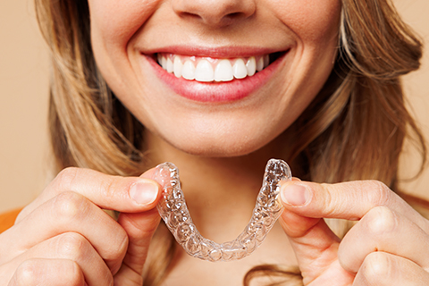 Clear Aligners