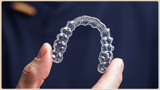 Clear Aligners