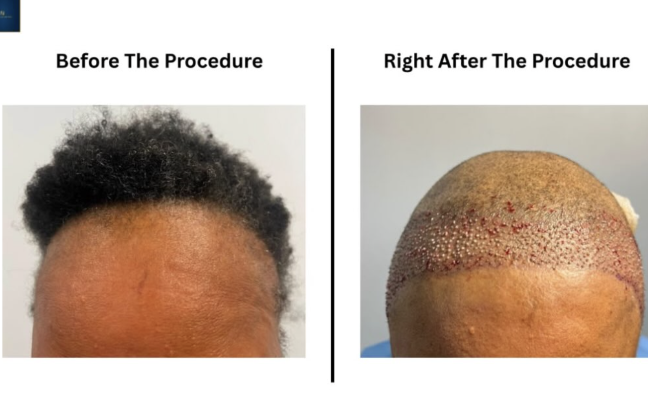 Patient progress case 3