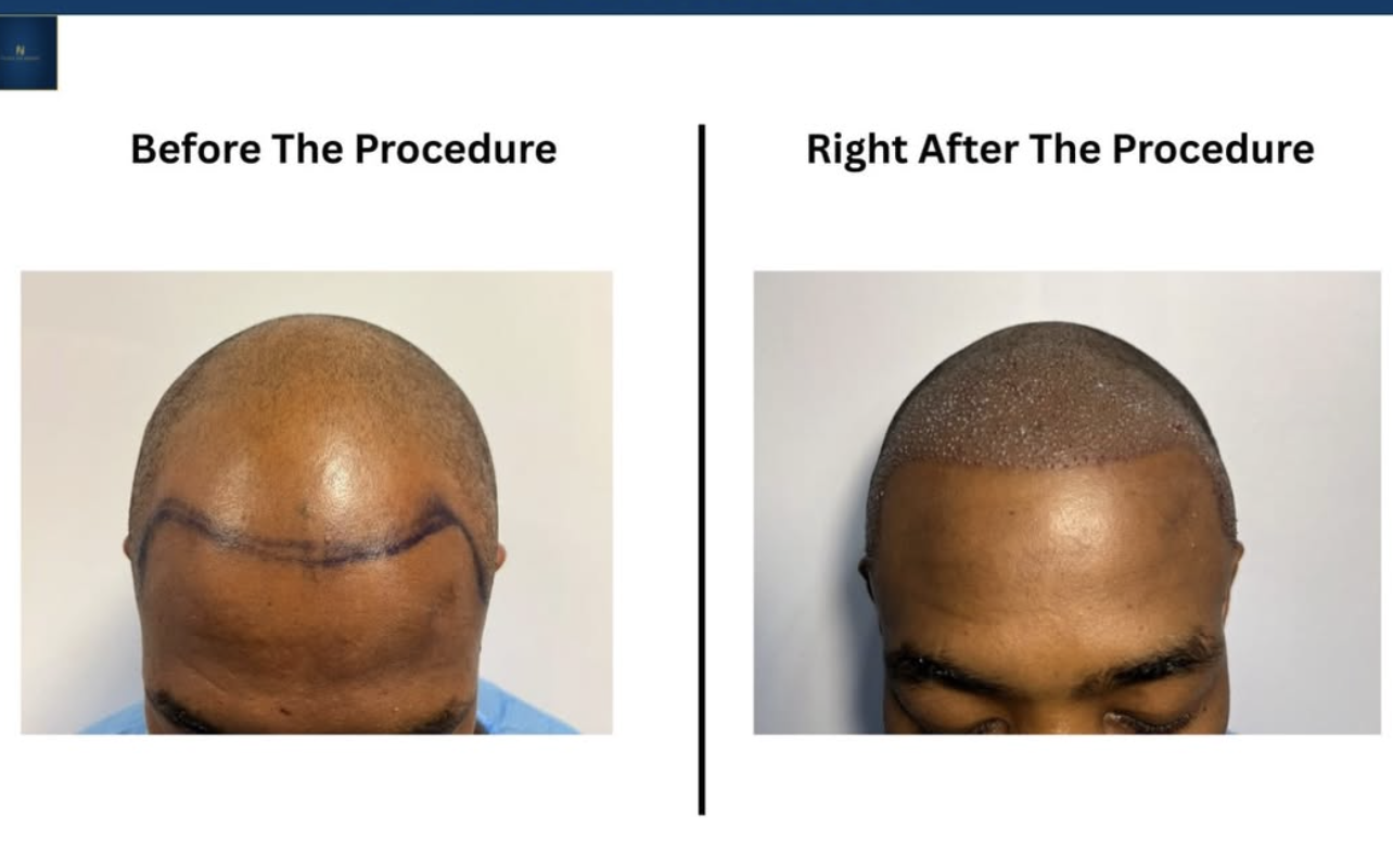 Patient progress case 2