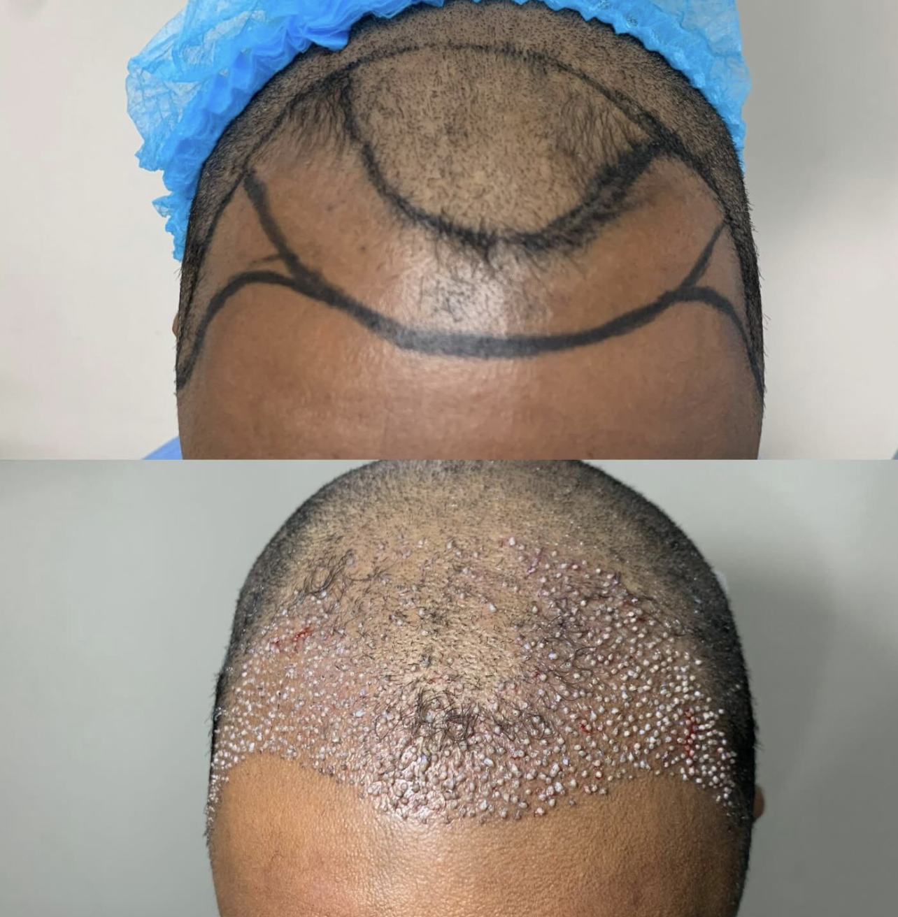 Patient progress case 1