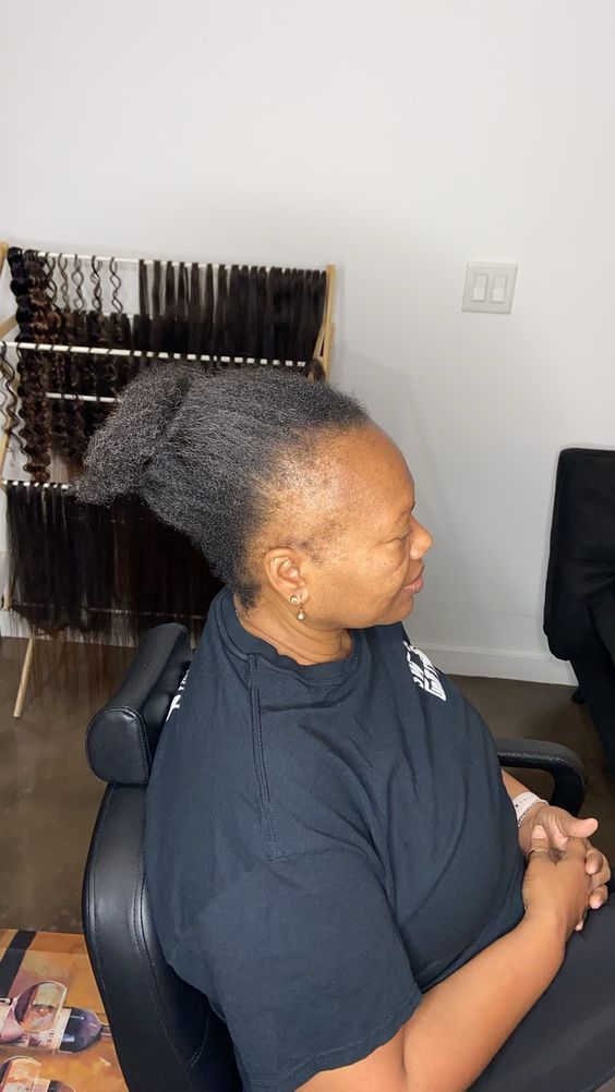 Close crop of a woman's hairline and edges, shown as a concern illustration.