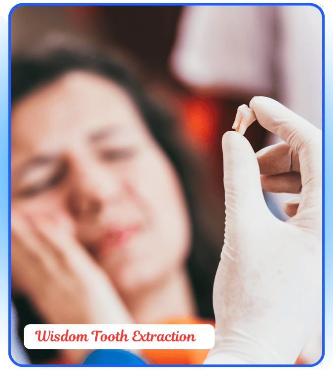 wisdom tooth extraction 