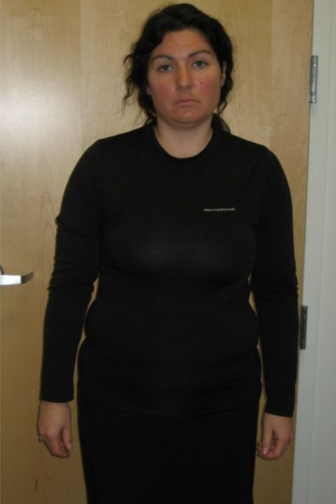Female patient before
