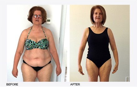 Client before and after