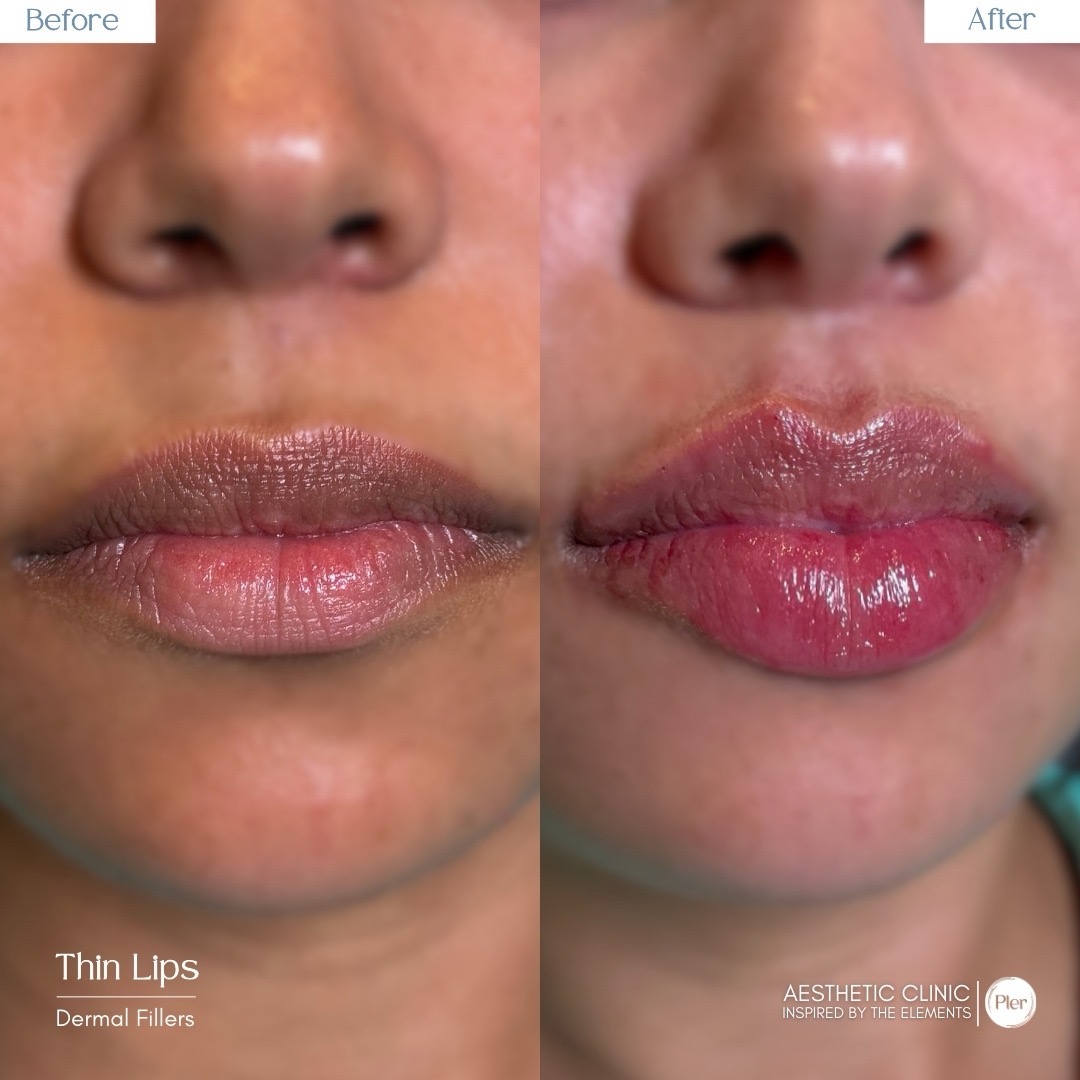 Before and After 5