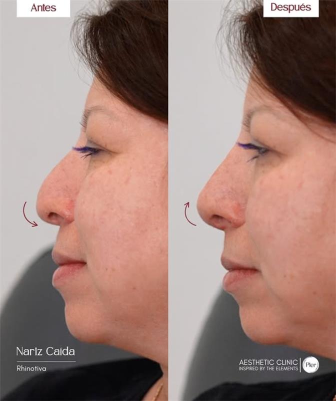 Before and After 3