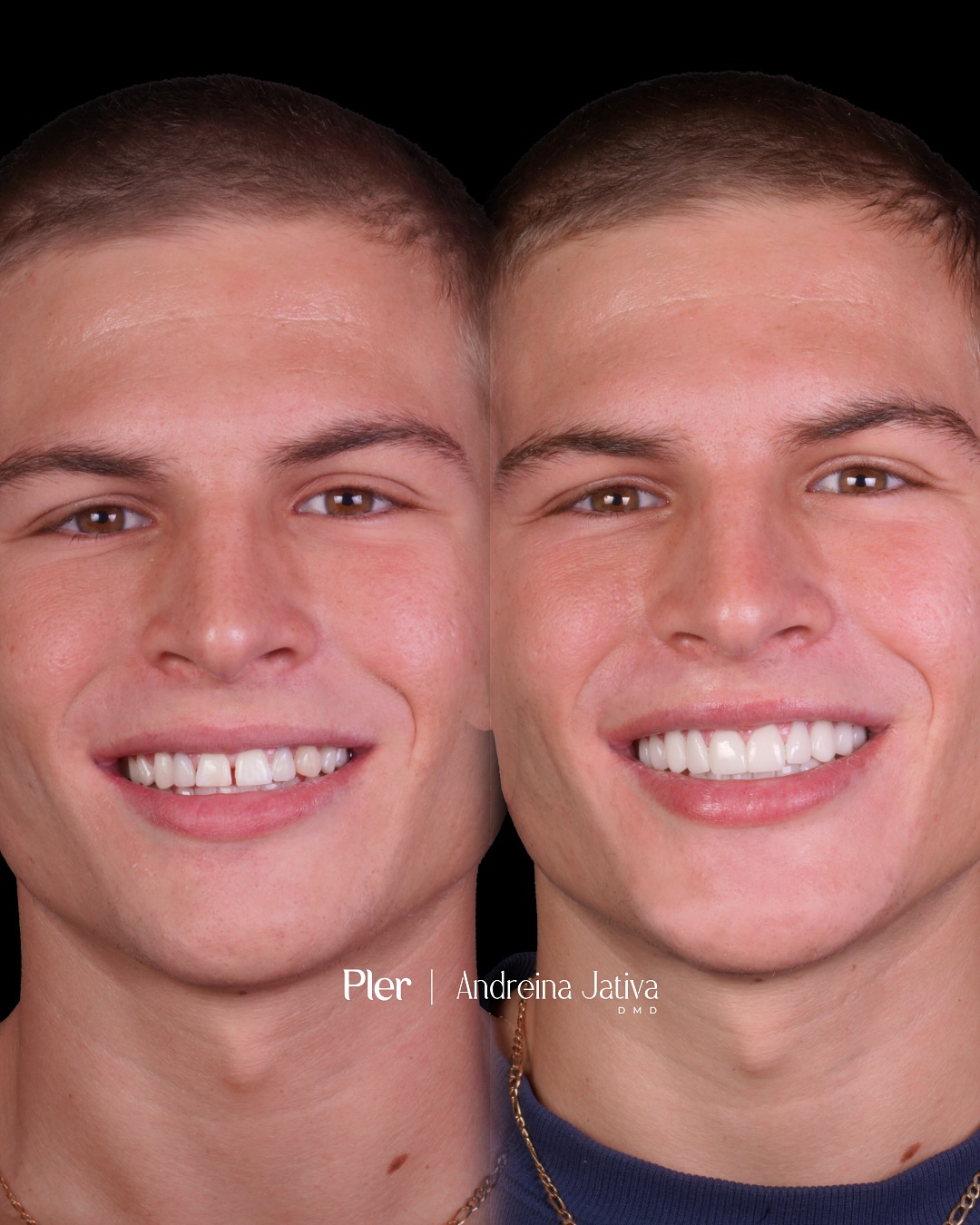 Before and After 6